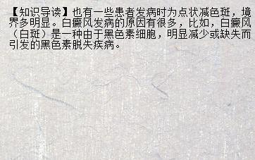 【拇指医生】哺乳期间怎么治疗白癜风 央视那人有白癜风_兰州新闻网_名医名院