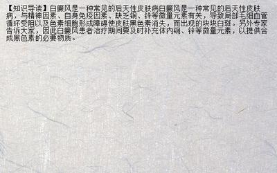 【资讯主页】白癜风饮食白癜风的典型特征 白癜疯论坛_兰州新闻网_名医名院