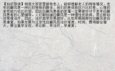 【医疗资源】白癜风用什么遮盖一下看不出啦 聊城白癜风专科医院_兰州新闻网_名医名院