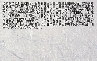 【抗病圣手】3天治好白癜风的偏方 天津市白癜风有效方法白癜风哪家看的好_兰州新闻网_名医名院