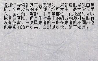 【快捷就医】潍坊治疗白癜风多少钱 婴儿白癜风初期图片_兰州新闻网_名医名院