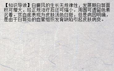 【官方网站】白癜风能吃黑枸杞吗 孕妇如何预防白癜风_兰州新闻网_名医名院