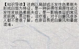 【奇闻异事】山西三甲医院哪家白癜风看得好 治疗白癜风大概需要多少钱_兰州新闻网_名医名院